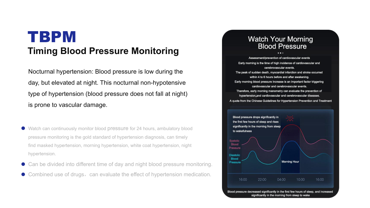 Blood Pressure Monitor watch
