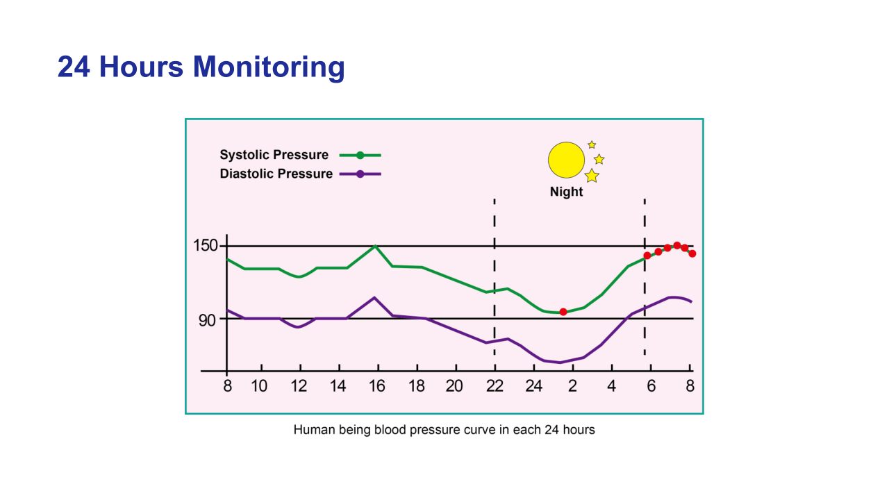 Blood Pressure Monitor watch